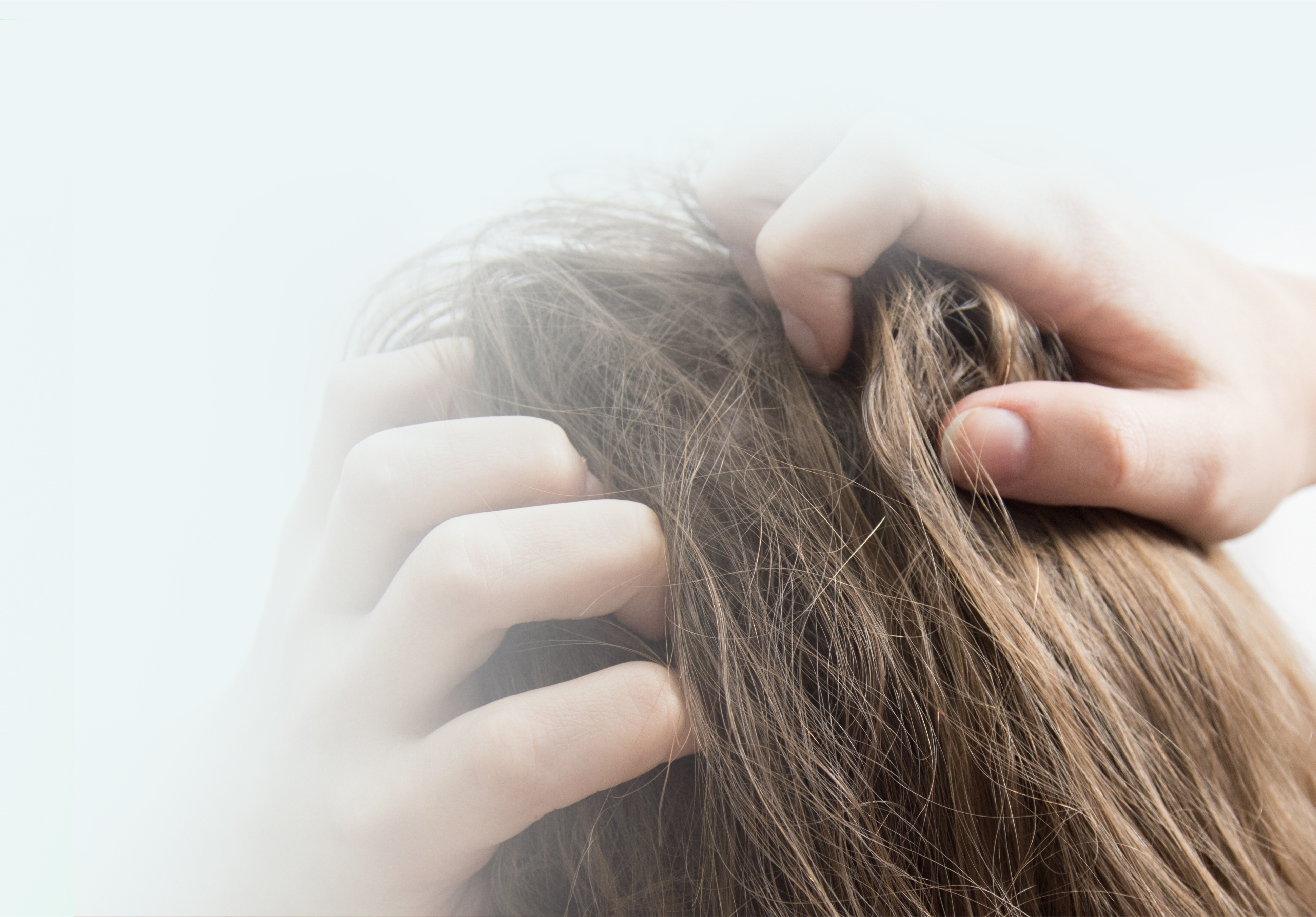 Dandruff Treatment